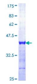 SDS-PAGE (BCL6-159H).jpg